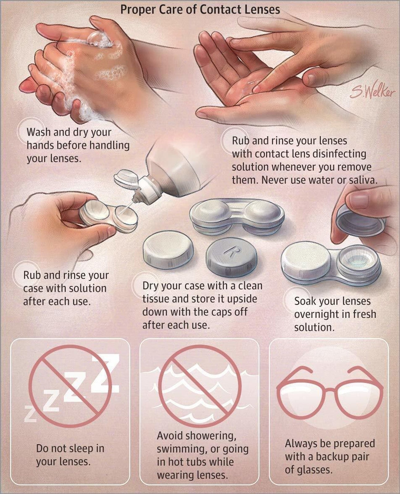 Roseleaf Monthly Disposable Contact Lenses (0.00 Power)