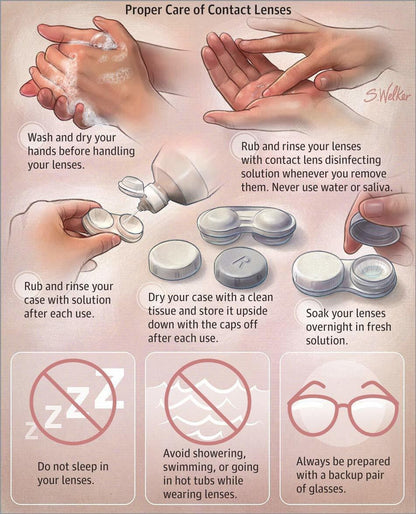Roseleaf Monthly Disposable Contact Lenses (0.00 Power)